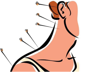 针灸缓解颈椎病疼痛，你知道其中的原理吗？