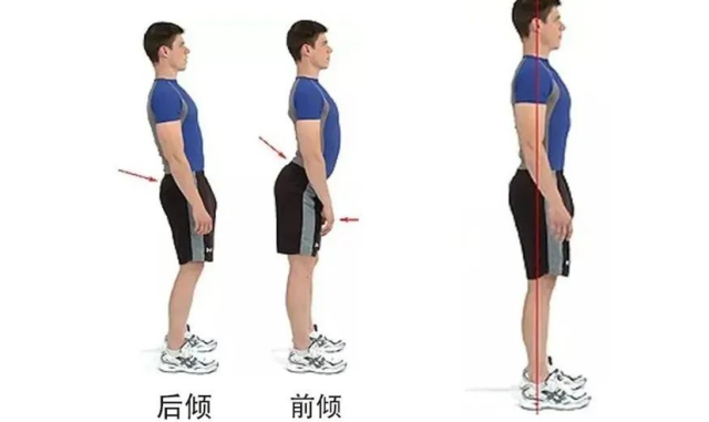久坐、便秘、猛健身，谁把腹壁“顶”成了疝？