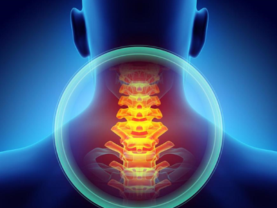 中医针灸是如何治疗颈椎病的？