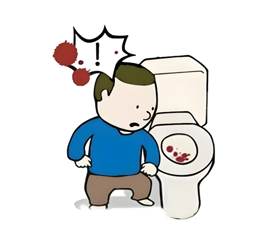便血=痔疮？别大意！可能是肠道发出的求救信号