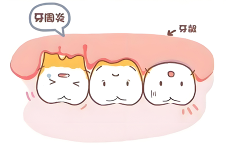 牙周炎怕掉牙？牙医叮嘱的5个日常护理要点，越早做越好！