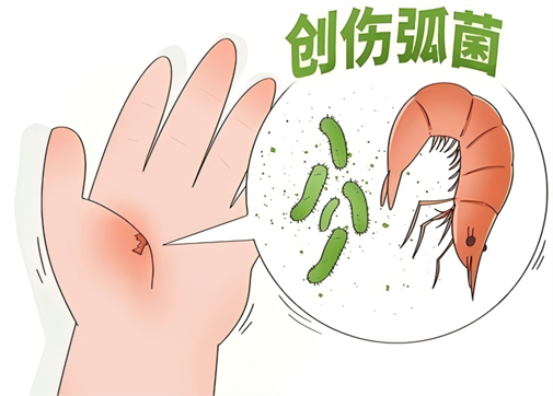 警惕“海洋杀手”创伤弧菌——感染可致截肢或致命！