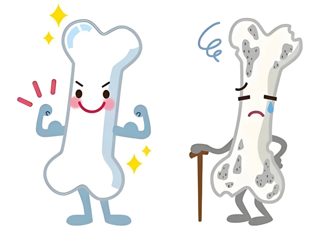 骨头酥了？别等老了才在骨骼银行存款！