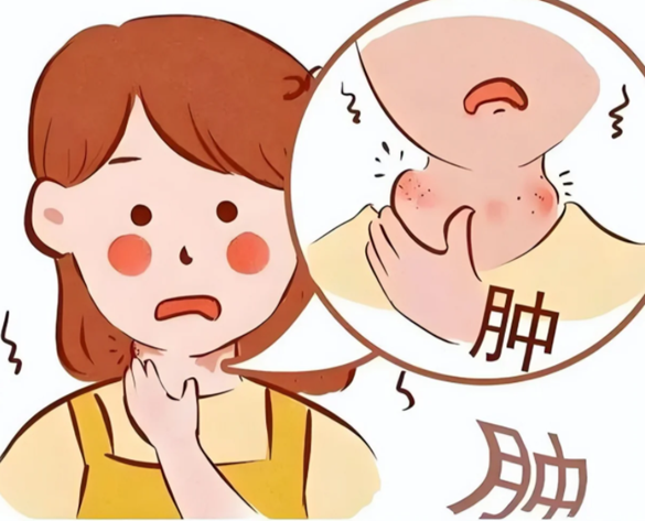 如何区分淋巴结肿大的“良性信号”与“危险预警”？