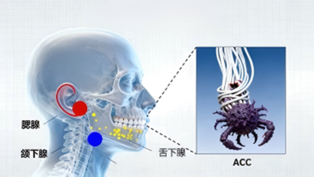 头颈腺样囊性癌：“沉默的侵袭者”的漫长战役