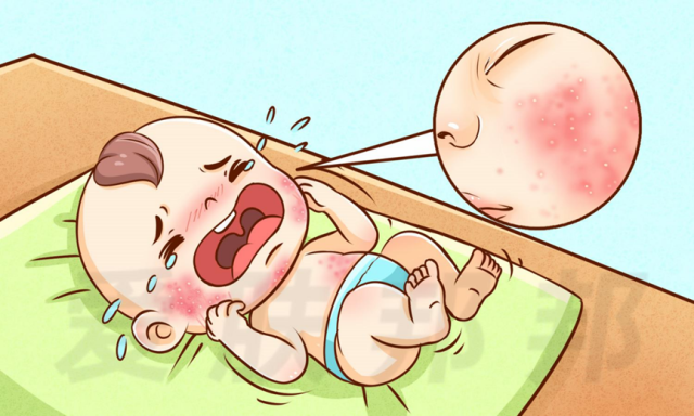 宝宝皮肤总“红痒干”？不是湿疹那么简单！