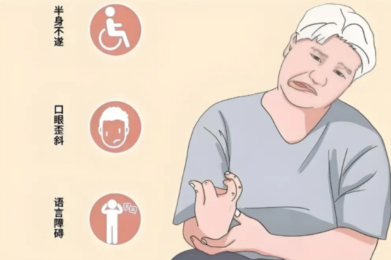 中风后遗症康复：中医针灸如何帮你“唤醒”肢体功能？