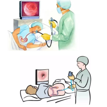 胃肠道的“高清相机巡检”：消化内镜如何成为你的健康侦察兵