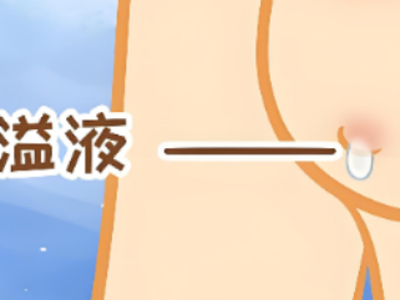 单孔漏水的真相：探秘乳头溢液与乳管镜诊断
