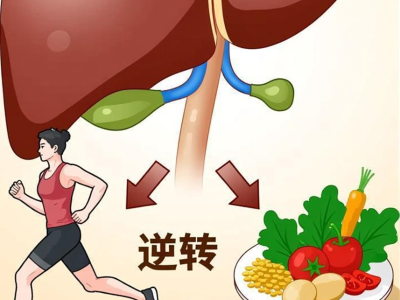 脂肪肝是慢病起点？“治未病”思路告诉你如何逆转