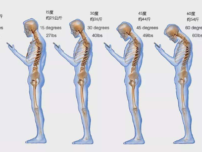 十人九颈痛：你的颈椎还好吗？