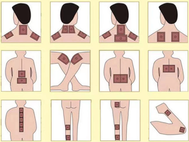 便捷有效的“理疗”，你真的了解吗？