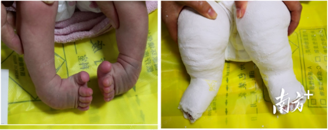 家门口挂“专家号”,大涌医联体让优质医疗资源“动”起来 受访者 供图