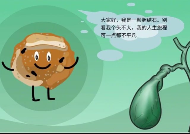 胆结石的奇幻漂流ERCP大冒险｜医视频