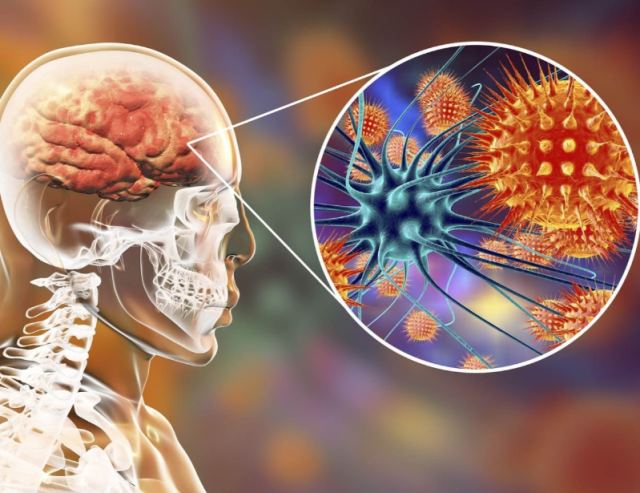 关于尼帕，武汉病毒研究所有新发现