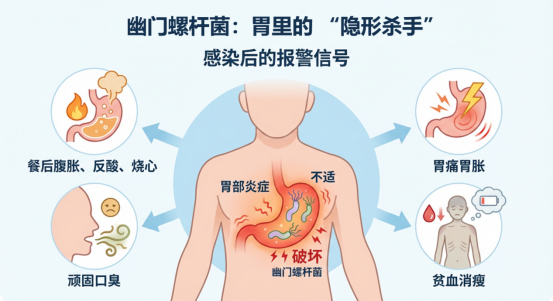 藏在胃里的“隐形杀手”——你可能正被幽门螺杆菌“盯上”