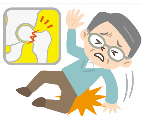 为啥髋部骨折被称作“人生最后一次骨折”?