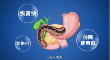 做完ERCP多久能洗澡活动?术后日常护理常见问题解答