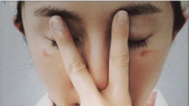 杨幂、张馨予同款“咬”伤：蒸汽眼罩怎么用才安全？｜健康深一度