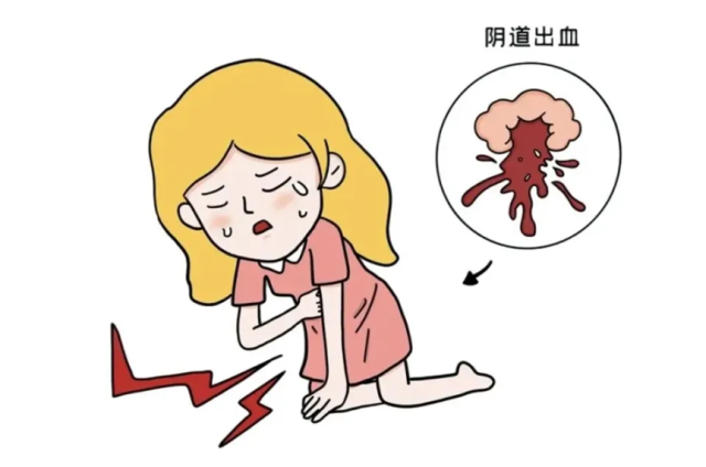 “宫外孕”到底有多危险？出现这些信号立刻去医院