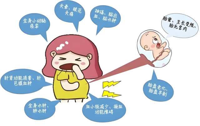 沉默的母婴杀手：子痫前期发病机制与三级预防策略