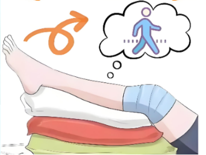 从躺到走再到跑:前交叉韧带术后康复时间表