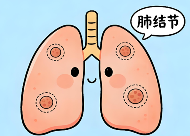 查出肺结节别恐慌,影像检查帮你精准辨良恶性