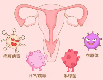 宫颈癌筛查全攻略,21岁以上女性必看!