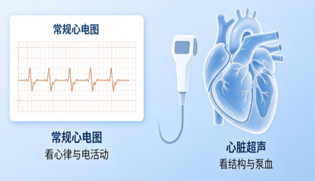 心功能检查,帮你了解心脏情况