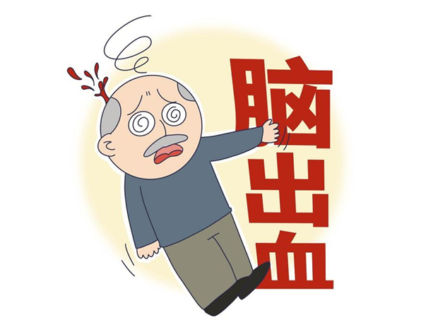 突发脑出血别拖延!牢记黄金救治要点