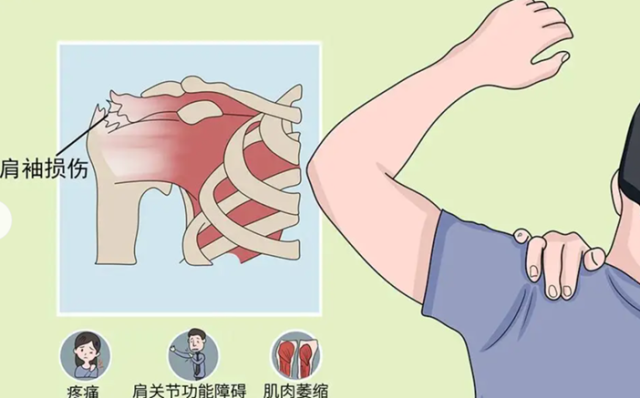 肩痛别乱甩胳膊锻炼!八成以上老年人肩痛不是肩周炎