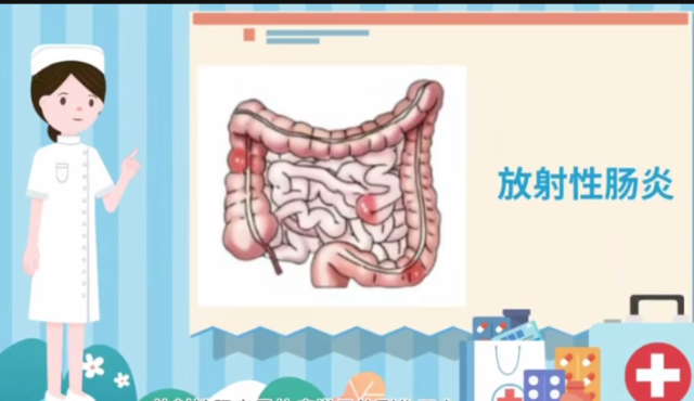 放射性肠炎的护理｜医视频