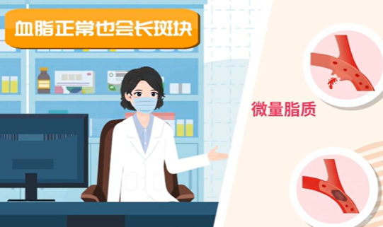 体检血脂正常，为啥还会脑梗？｜医视频