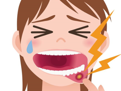 口腔黏膜病：早防早治少受罪！
