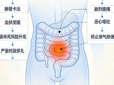 疝气不是小事，拖延不治会有哪些危险