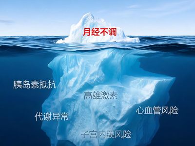 多内分泌代谢卵巢综合征：它不是“妇科病”，是“全身代谢病”