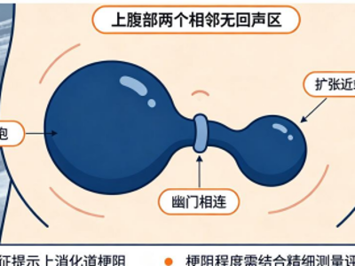 超声镜头下的胎儿肠道堵车信号