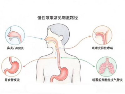 久咳 2 月反复发作，警惕难治性慢性咳嗽